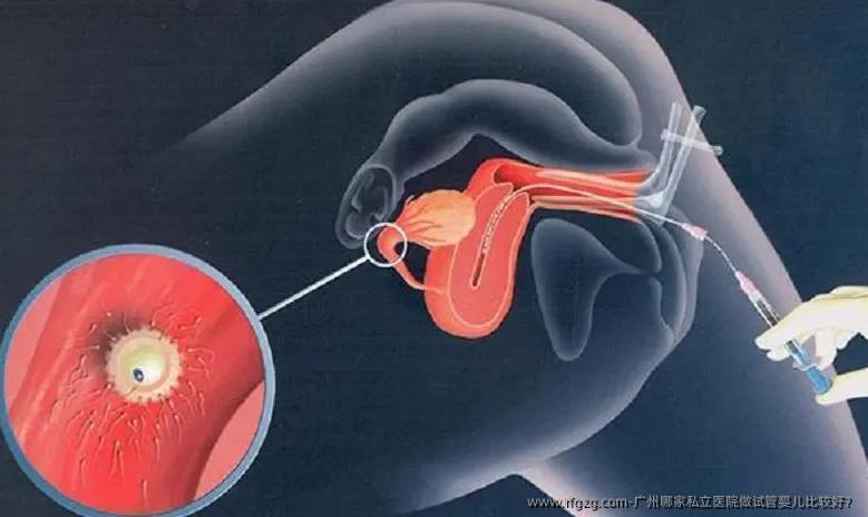 广州哪家私立医院做代孕比较好？