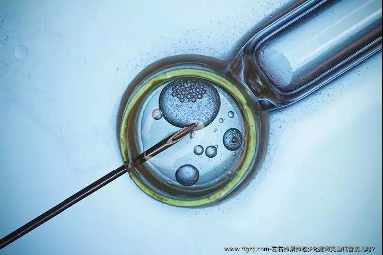 左右卵巢卵泡少还能做美国代孕吗？ 