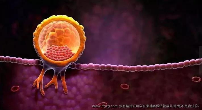 没有结婚证可以在柬埔寨做代孕吗?是不是合法的?