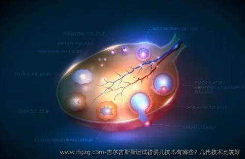 吉尔吉斯斯坦代孕技术有哪些？几代技术比较好