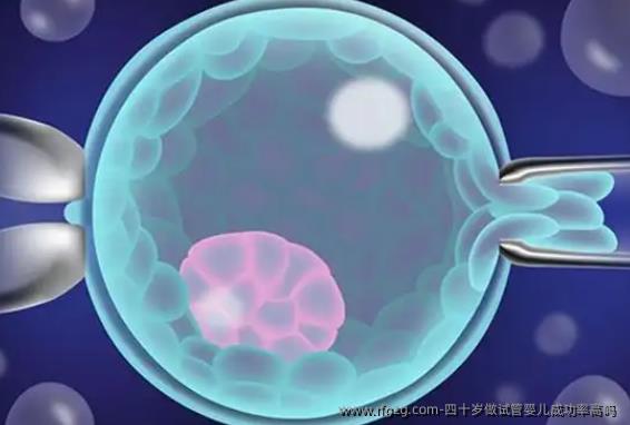 四十岁做代孕成功率高吗 