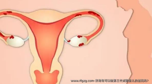 济南有可以做第三代代孕的医院吗？