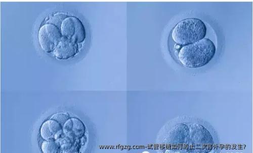 试管移植如何防止二次宫外孕的发生？